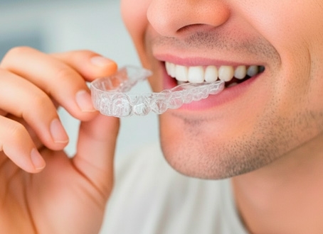 Şeffaf Plak Tedavisi Etlik